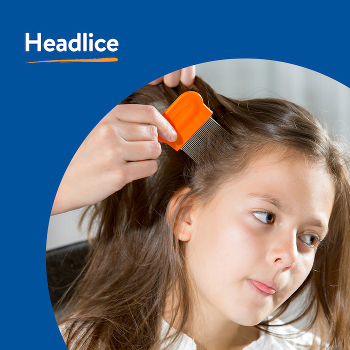 Headlice